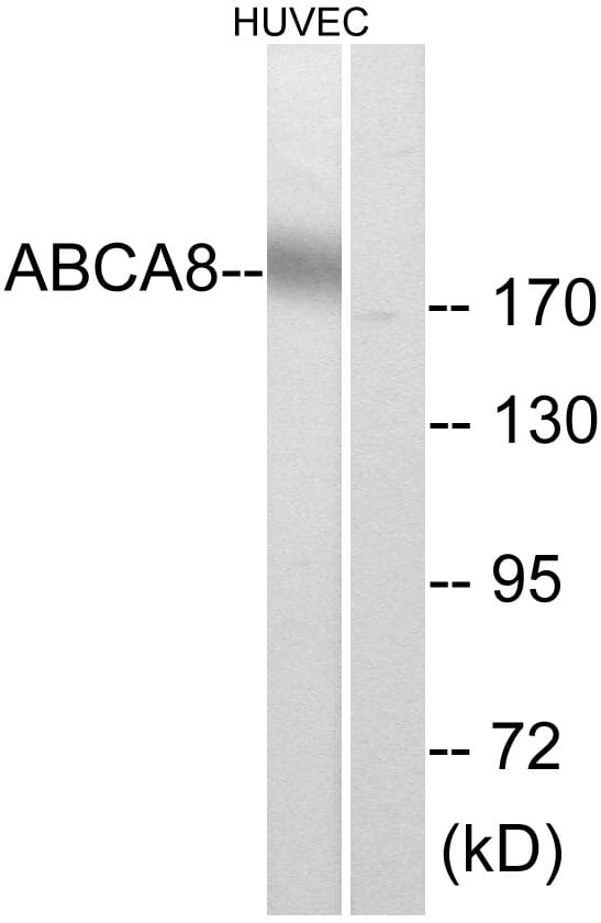 Western blot analysis of lysates from HUVEC cells using Anti-ABCA8 Antibody. The right hand lane represents a negative control, where the antibody is blocked by the immunising peptide.
