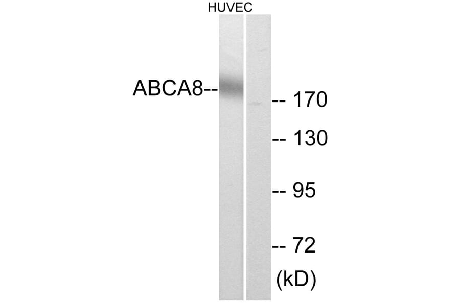 Western Blot - Anti-ABCA8 Antibody (C14617) - Antibodies.com