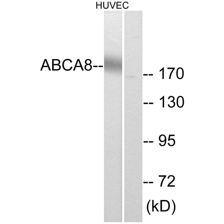 Western Blot - Anti-ABCA8 Antibody (C14617) - Antibodies.com