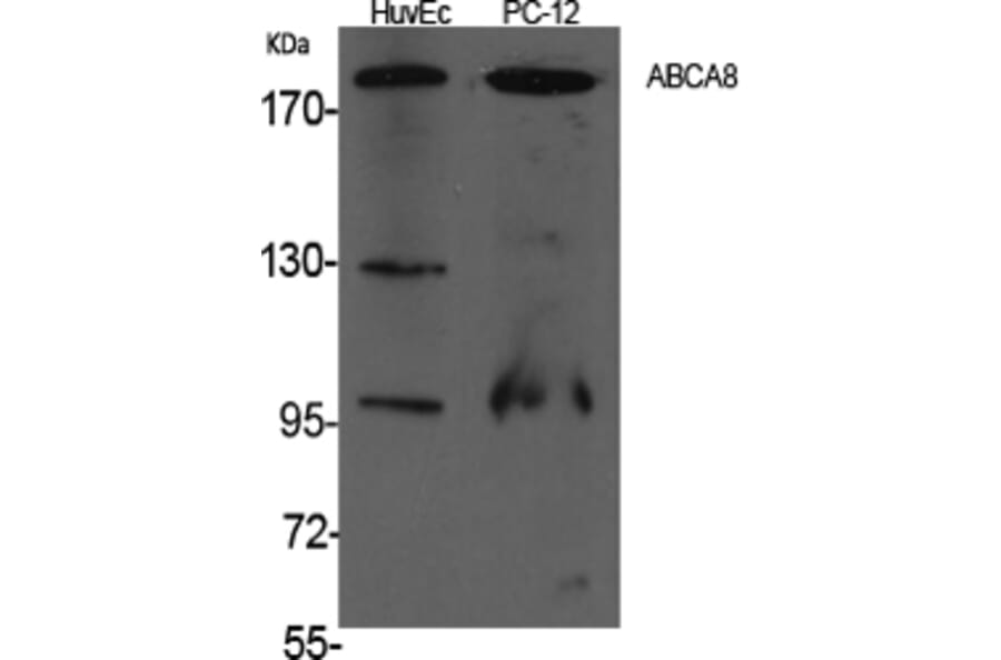 Western Blot - Anti-ABCA8 Antibody (C14617) - Antibodies.com