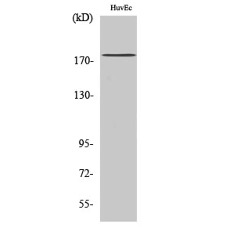 Western Blot - Anti-ABCA8 Antibody (C14617) - Antibodies.com