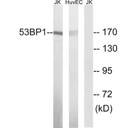 Western Blot - Anti-53BP1 Antibody (B8284) - Antibodies.com
