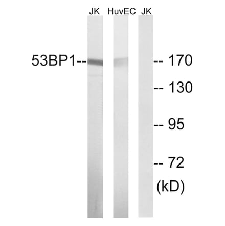 Western Blot - Anti-53BP1 Antibody (B8284) - Antibodies.com