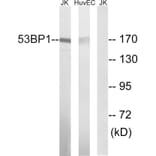 Western Blot - Anti-53BP1 Antibody (B8284) - Antibodies.com