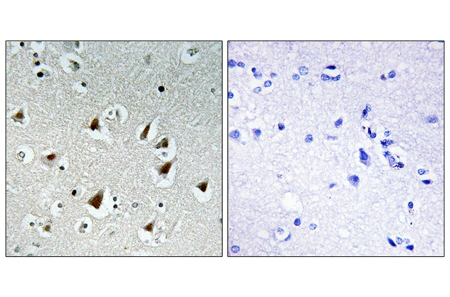 Immunohistochemistry - Anti-ZHX2 Antibody (C11999) - Antibodies.com