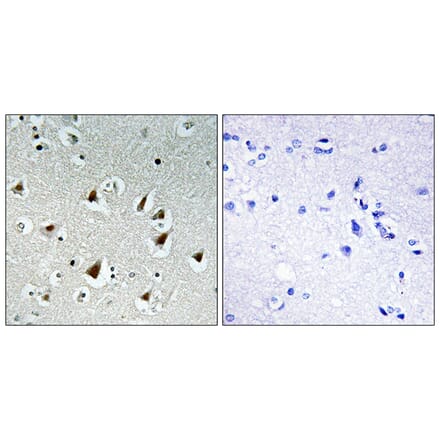 Immunohistochemistry - Anti-ZHX2 Antibody (C11999) - Antibodies.com