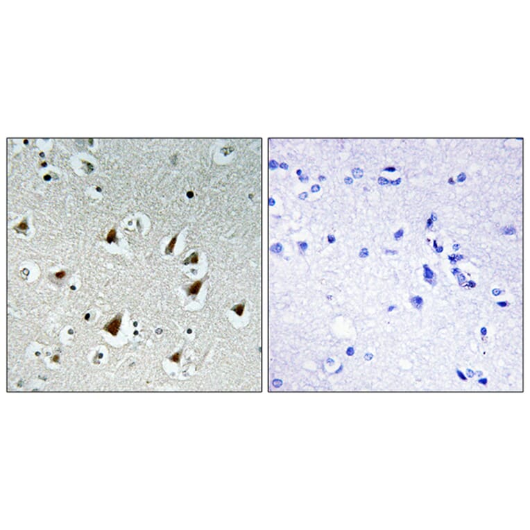 Immunohistochemistry - Anti-ZHX2 Antibody (C11999) - Antibodies.com