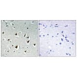 Immunohistochemistry - Anti-ZHX2 Antibody (C11999) - Antibodies.com