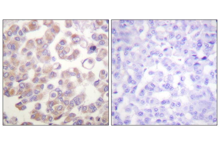 Immunohistochemistry - Anti-WNT1 Antibody (C0392) - Antibodies.com