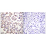 Immunohistochemistry - Anti-WNT1 Antibody (C0392) - Antibodies.com