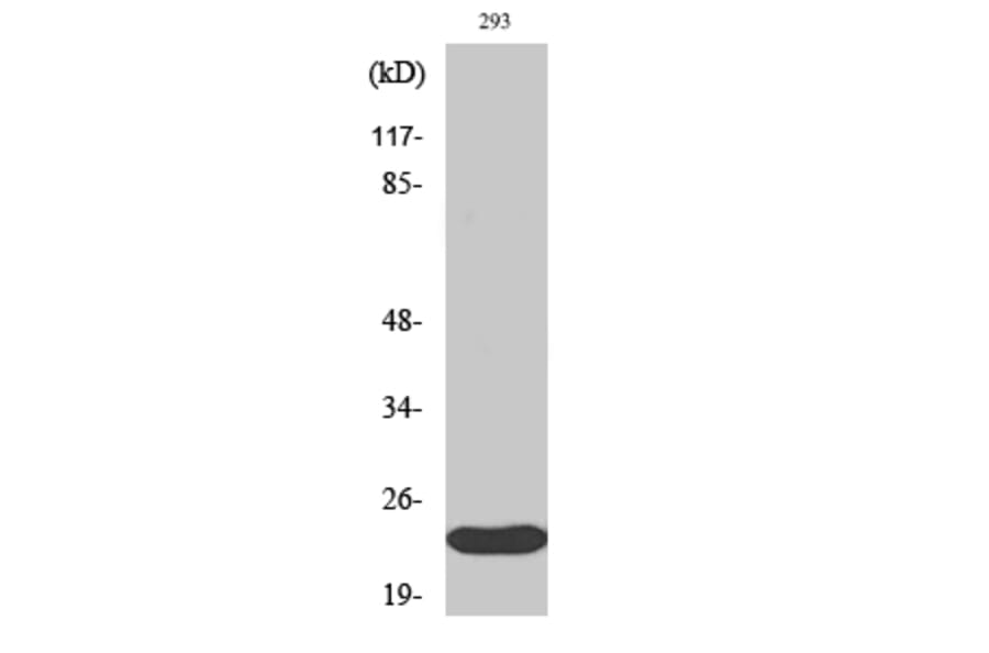 Western Blot - Anti-ULK3 Antibody (C18627) - Antibodies.com