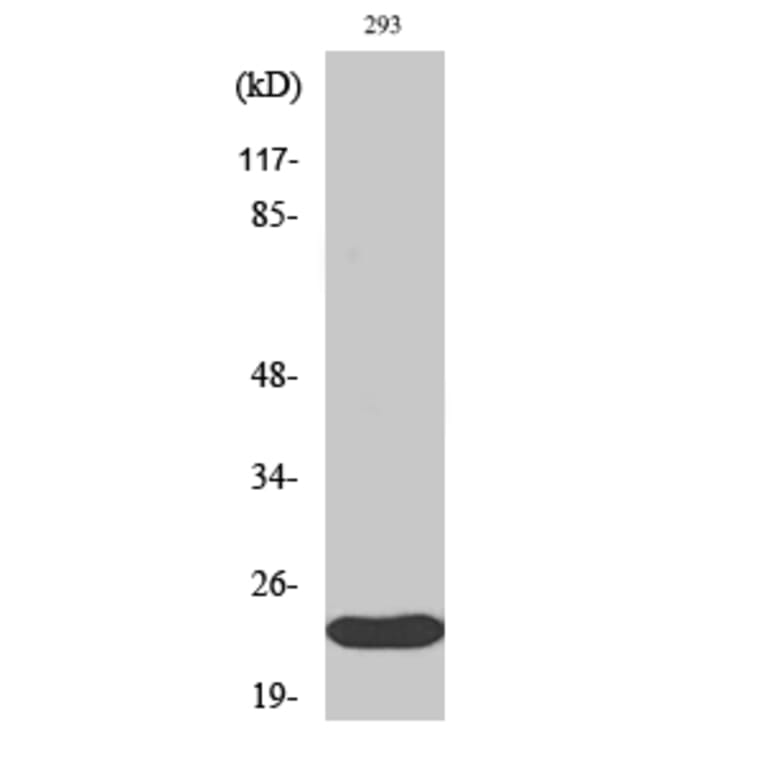 Western Blot - Anti-ULK3 Antibody (C18627) - Antibodies.com