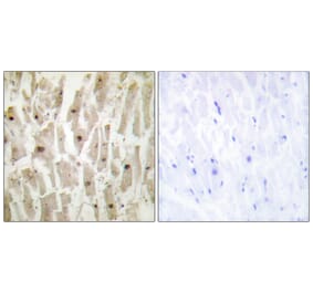 Immunohistochemistry - Anti-TSH1 Antibody (C11240) - Antibodies.com