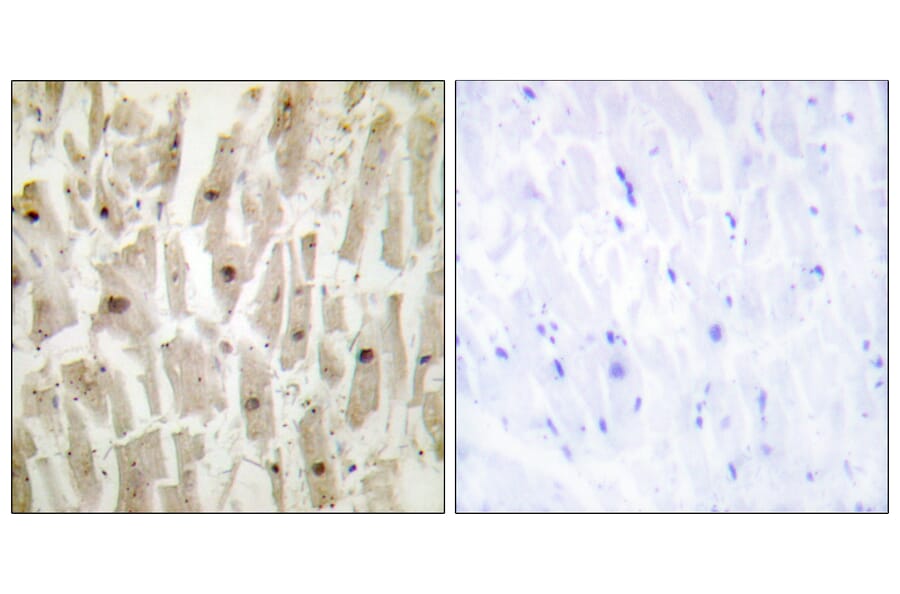 Immunohistochemistry - Anti-TSH1 Antibody (C11240) - Antibodies.com