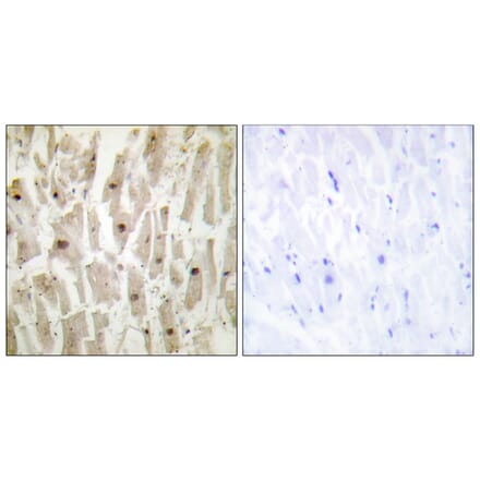 Immunohistochemistry - Anti-TSH1 Antibody (C11240) - Antibodies.com