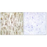 Immunohistochemistry - Anti-TSH1 Antibody (C11240) - Antibodies.com