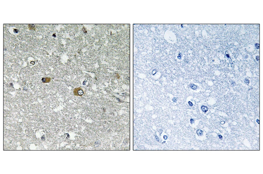 Immunohistochemistry - Anti-PIGH Antibody (C17674) - Antibodies.com