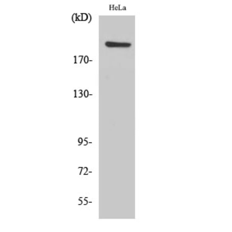 Western Blot - Anti-PHF3 Antibody (C17658) - Antibodies.com