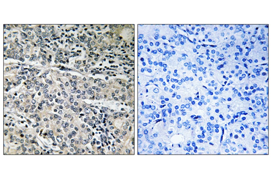 Immunohistochemistry - Anti-MP68 Antibody (C14139) - Antibodies.com
