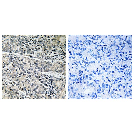 Immunohistochemistry - Anti-MP68 Antibody (C14139) - Antibodies.com