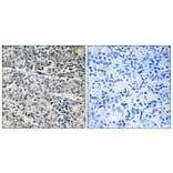 Immunohistochemistry - Anti-MP68 Antibody (C14139) - Antibodies.com