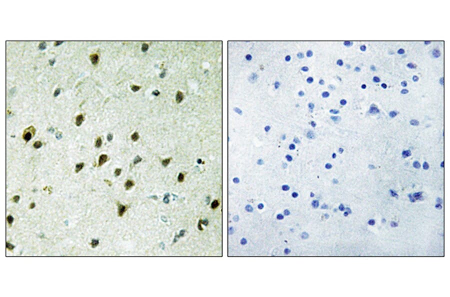 Immunohistochemistry - Anti-MAD4 Antibody (C11039) - Antibodies.com