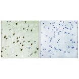 Immunohistochemistry - Anti-MAD4 Antibody (C11039) - Antibodies.com