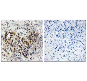 Immunohistochemistry - Anti-IRX3 Antibody (C10796) - Antibodies.com