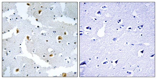 Immunohistochemical analysis of paraffin-embedded human brain tissue using Anti-FMN2 Antibody. The right hand panel represents a negative control, where the antibody was pre-incubated with the immunising peptide.