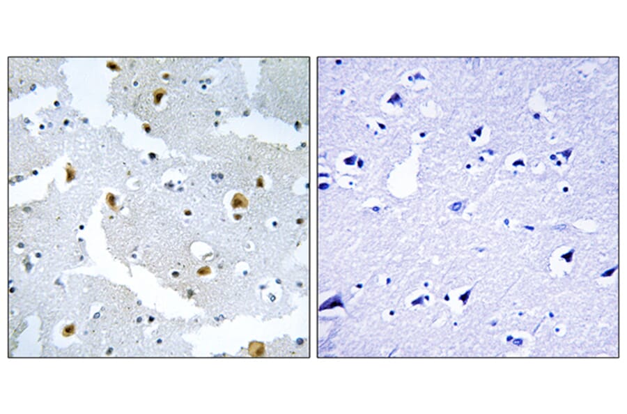 Immunohistochemistry - Anti-FMN2 Antibody (C15806) - Antibodies.com