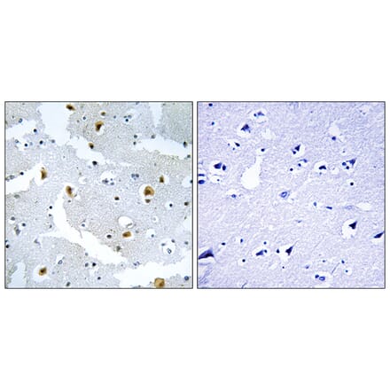 Immunohistochemistry - Anti-FMN2 Antibody (C15806) - Antibodies.com