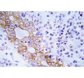 Immunohistochemistry - Anti-FLT3 Antibody (R12-2144) - Antibodies.com