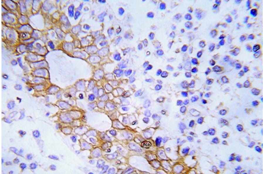 Immunohistochemistry - Anti-FLT3 Antibody (R12-2144) - Antibodies.com