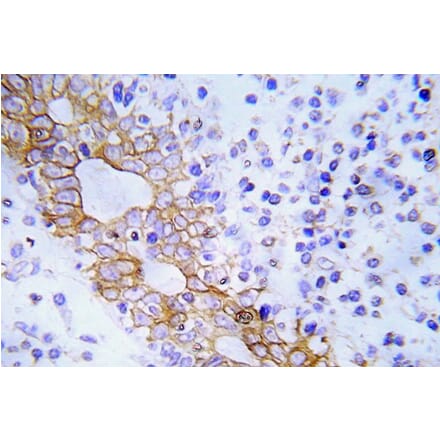 Immunohistochemistry - Anti-FLT3 Antibody (R12-2144) - Antibodies.com