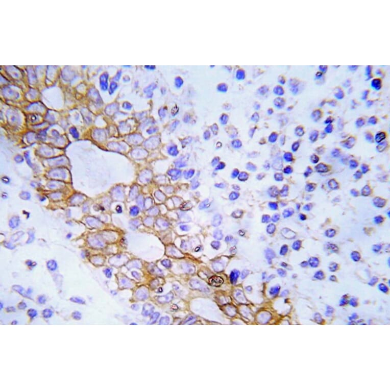 Immunohistochemistry - Anti-FLT3 Antibody (R12-2144) - Antibodies.com