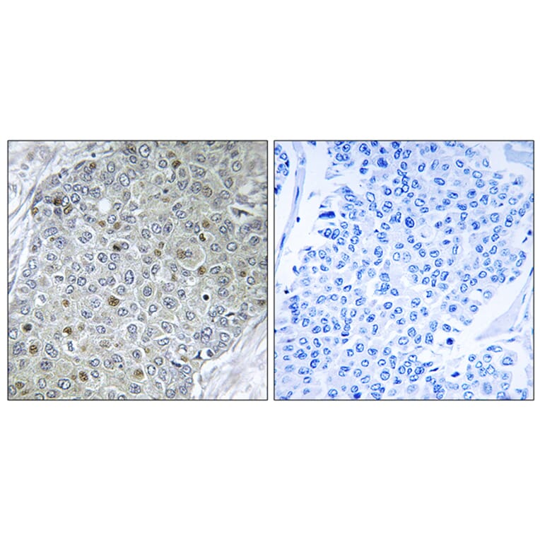 Immunohistochemistry - Anti-ETV4 Antibody (C10614) - Antibodies.com