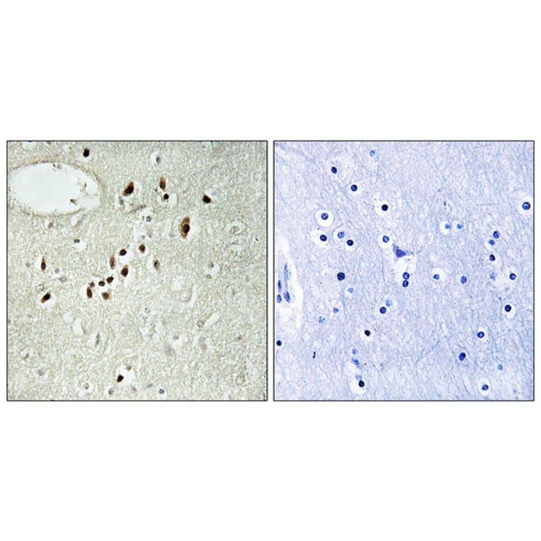Immunohistochemistry - Anti-EMX2 Antibody (C10877) - Antibodies.com