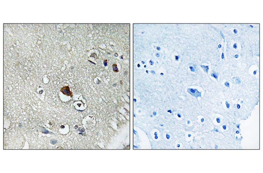 Immunohistochemistry - Anti-DVL3 Antibody (C18495) - Antibodies.com