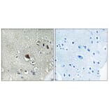 Immunohistochemistry - Anti-DVL3 Antibody (C18495) - Antibodies.com