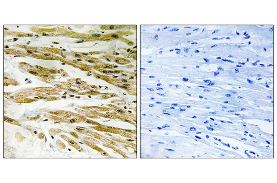 Immunohistochemistry - Anti-DMC1 Antibody (C13043) - Antibodies.com