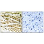 Immunohistochemistry - Anti-DMC1 Antibody (C13043) - Antibodies.com