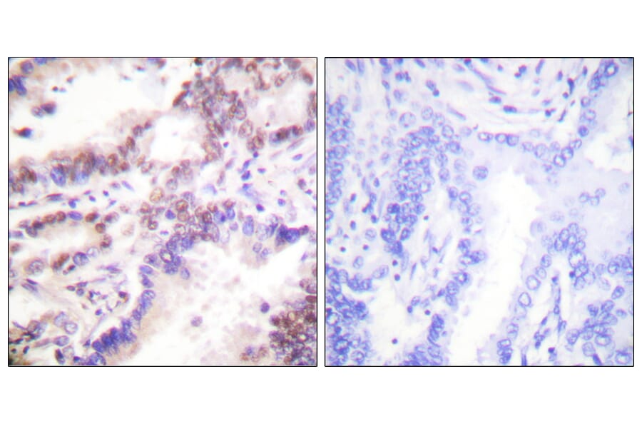 Immunohistochemistry - Anti-CTIP Antibody (B0416) - Antibodies.com