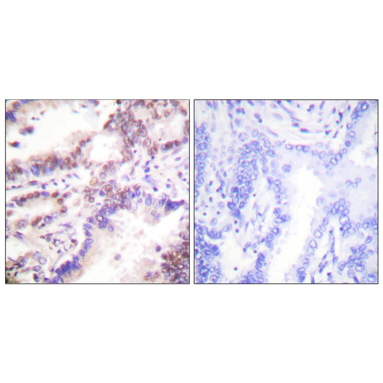 Immunohistochemistry - Anti-CTIP Antibody (B0416) - Antibodies.com