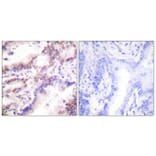 Immunohistochemistry - Anti-CTIP Antibody (B0416) - Antibodies.com