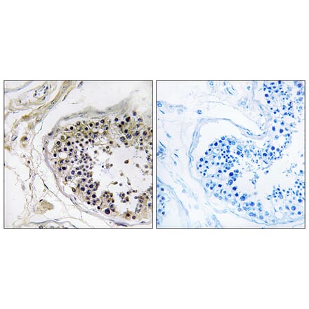 Immunohistochemistry - Anti-CST8 Antibody (C15271) - Antibodies.com
