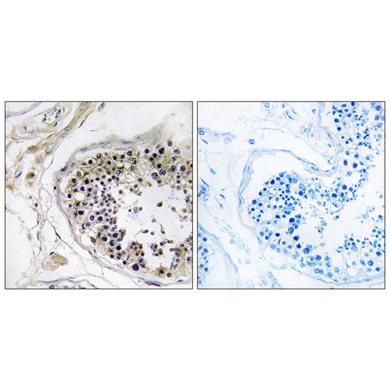 Immunohistochemistry - Anti-CST8 Antibody (C15271) - Antibodies.com