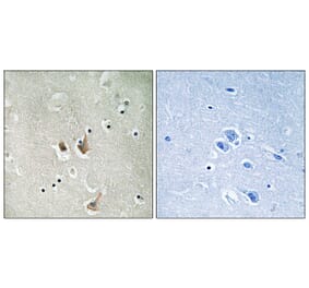 Immunohistochemistry - Anti-CKS2 Antibody (C10543) - Antibodies.com