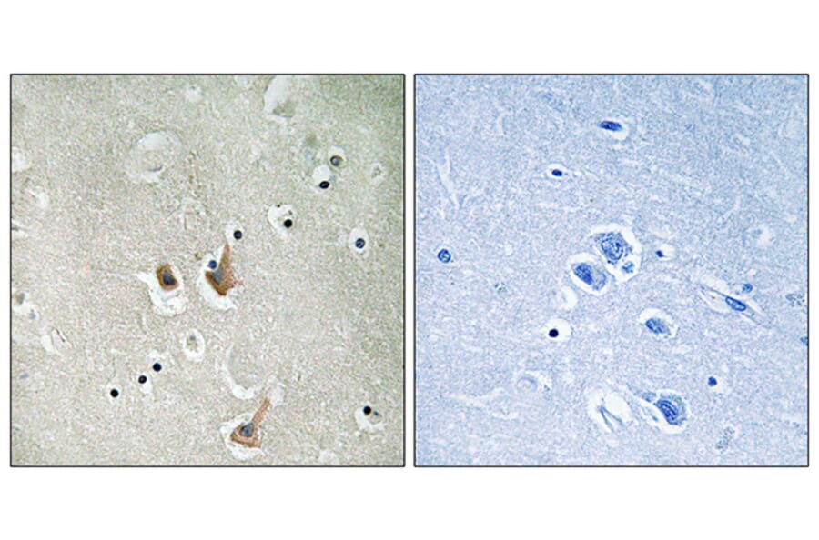 Immunohistochemistry - Anti-CKS2 Antibody (C10543) - Antibodies.com