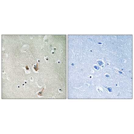 Immunohistochemistry - Anti-CKS2 Antibody (C10543) - Antibodies.com