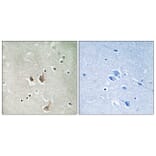 Immunohistochemistry - Anti-CKS2 Antibody (C10543) - Antibodies.com
